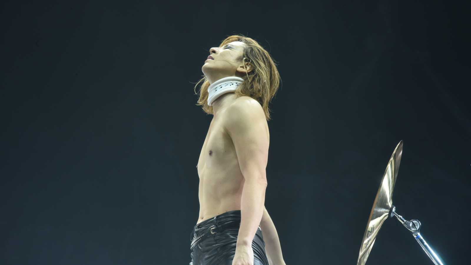 YOSHIKI to Undergo Third Neck Surgery © Courtesy of YOSHIKI